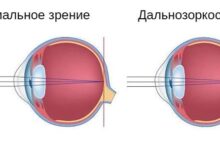 Photo of Виды дефектов зрения и способы их исправления